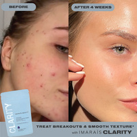 CLARITY – Gummies soins anti-imperfections